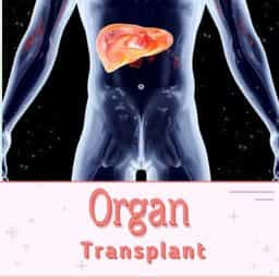 Organ Transplant